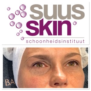 PMU eyeliner - Suusskin Oosterhout